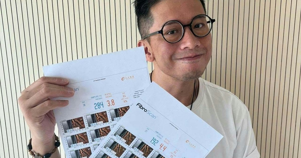Hong Kong Celebrities Share Fatty Liver Recovery Stories with 'Liver Health Treasure' Product