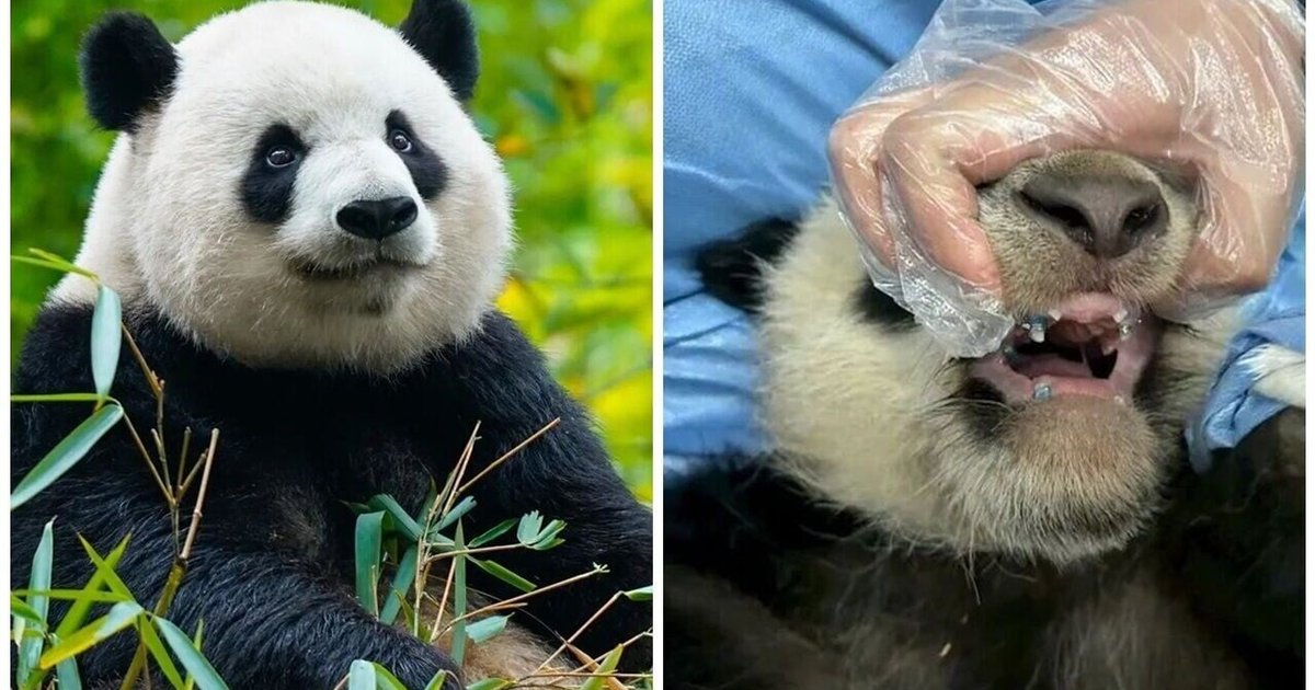 全球首例!成都大熊貓「北俠」獨臂歪面戴牙套矫正 康復迎4歲生日