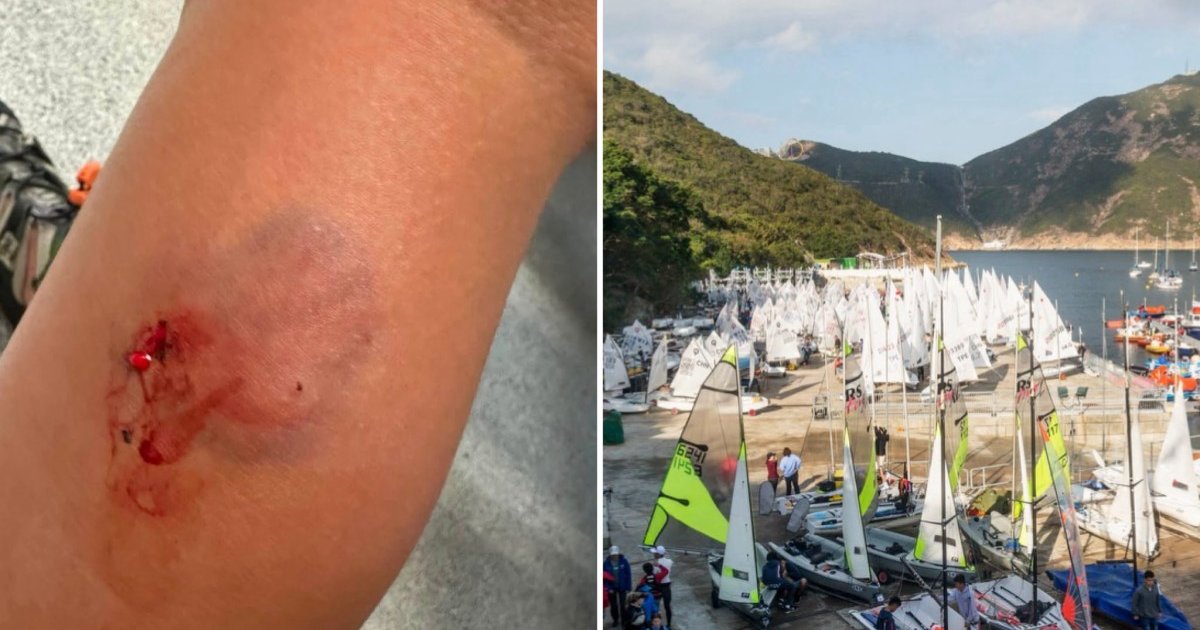 Seven-Year-Old Bitten by Off-Leash Corgi at Royal Hong Kong Yacht Club