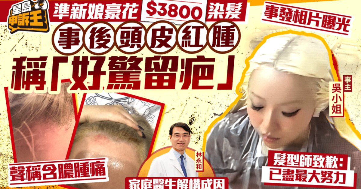Bride-to-Be Sues Salon Over $3,800 Hair Dye Reaction, Alleges Scalp Damage