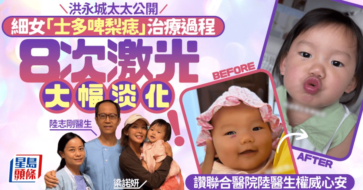 洪永城太太公开细女"草莓痣"治疗过程 8次激光大幅淡化 赞联合医院陆医生权威安心