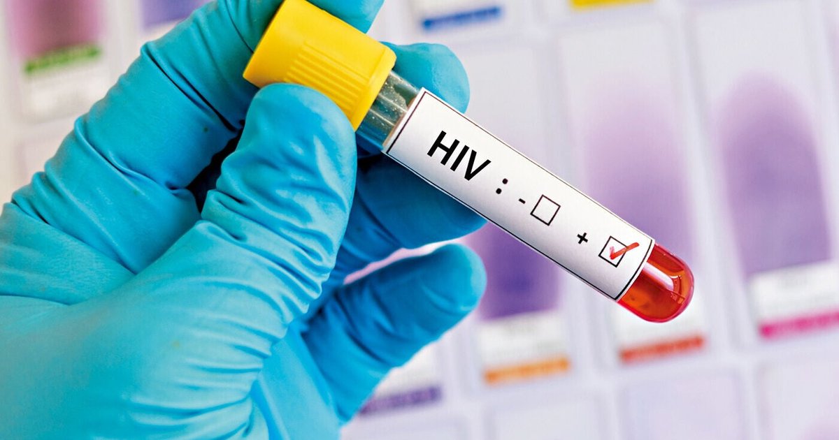 Over 90% Support Same-Day HIV Treatment After Diagnosis in Hong Kong