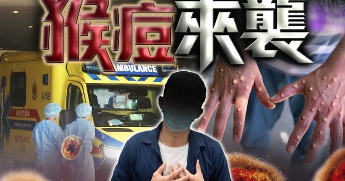 31歲男子確診猴痘　曾與陌生男子有高風險接觸