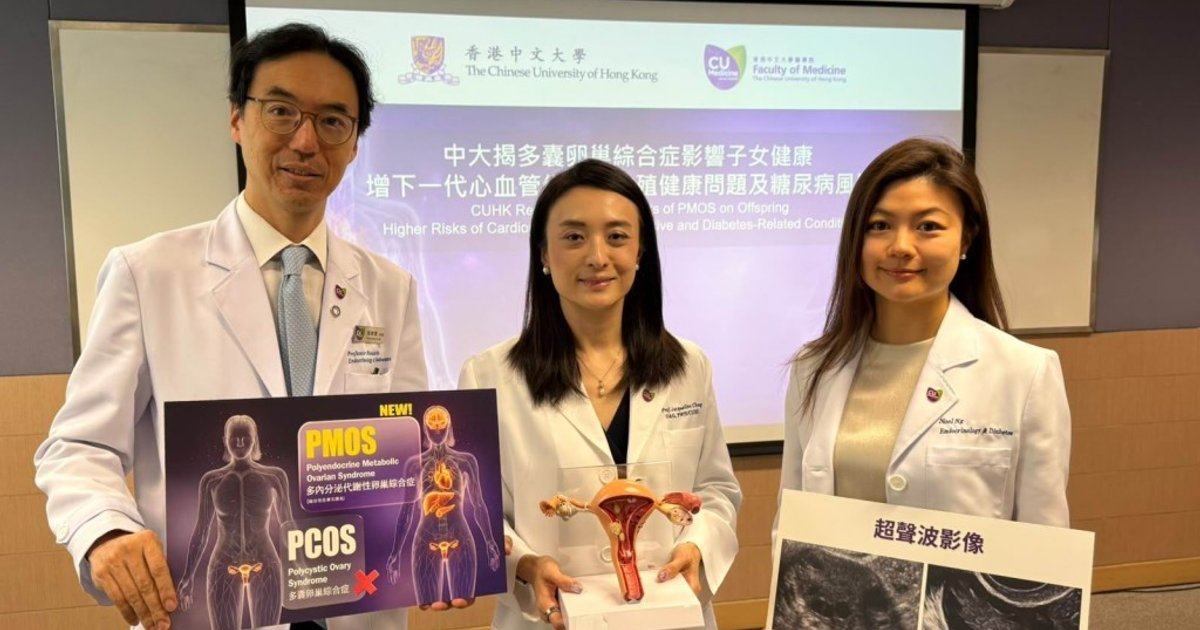 中大研究揭多內分泌代謝性卵巢綜合症影響患者後代健康