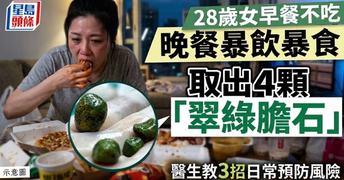 Guiyang Woman Has 4 Rare Turquoise Gallstones Removed; Doctors Warn Against Skipping Breakfast