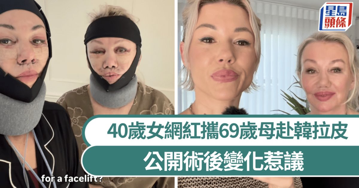 40-Year-Old Australian Influencer Takes 69-Year-Old Mother to South Korea for Facelifts
