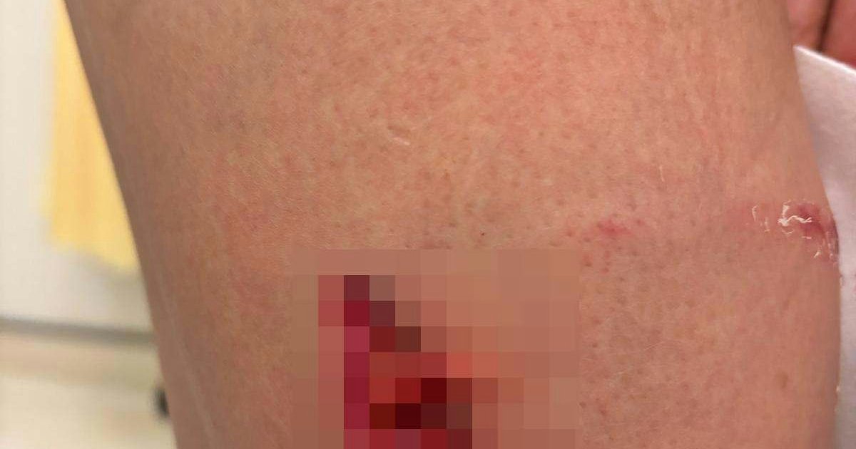 Woman Bitten by Large Dog in Fanling Estate; AFCD Cites Insufficient Evidence for No Prosecution