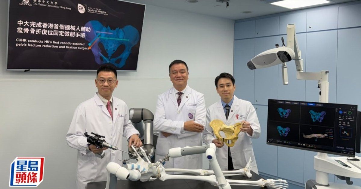 中大完成全港首宗机器人辅助盆骨骨折微创手术 出血量仅十至二十毫升