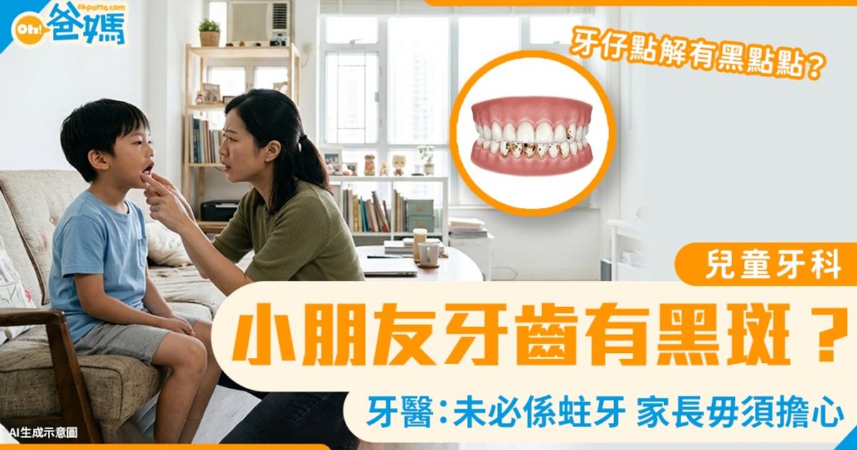 牙齒「黑黑的」是否蛀牙?兒童牙科專科醫師:家長毋須過度擔心
